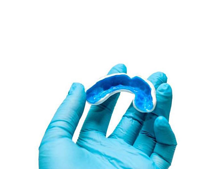 mouthguard for dental implant care in Toronto